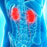 Nierenprobleme verstehen: Symptome, Diagnose und Behandlungsoptionen im Überblick